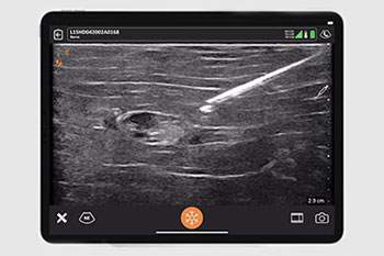 guided injections