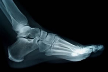 x-ray