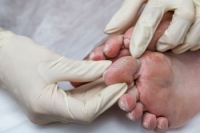 Foot Care for Diabetic Health