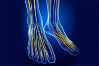 Uncovering Nerve Entrapment Syndromes in the Foot and Ankle